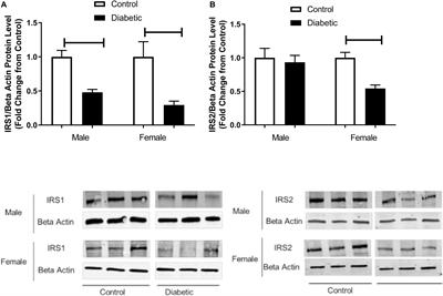 Potentiation of Acetylcholine-Induced Relaxation of Aorta in Male UC Davis Type 2 Diabetes Mellitus (UCD-T2DM) Rats: Sex-Specific Responses